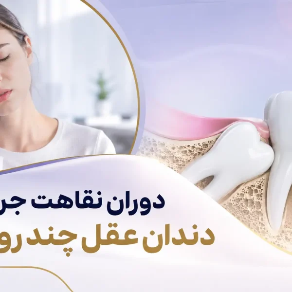دوران نقاهت جراحی دندان عقل
