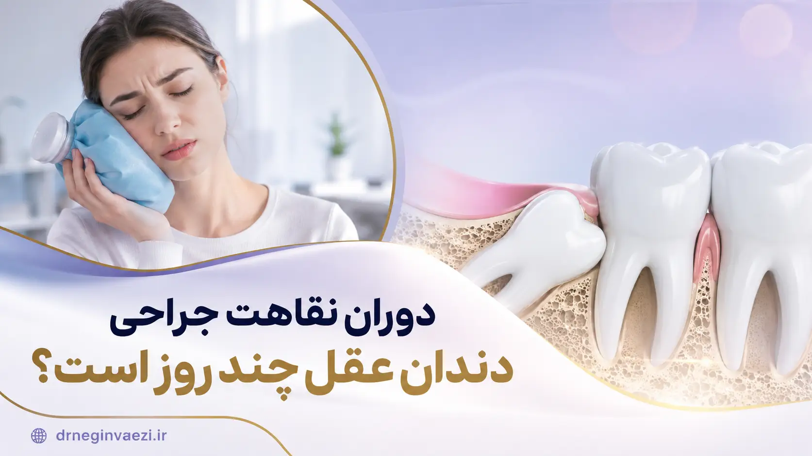 دوران نقاهت جراحی دندان عقل