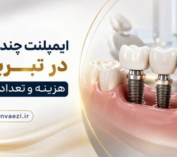Implant chand dandan tabriz 360x320