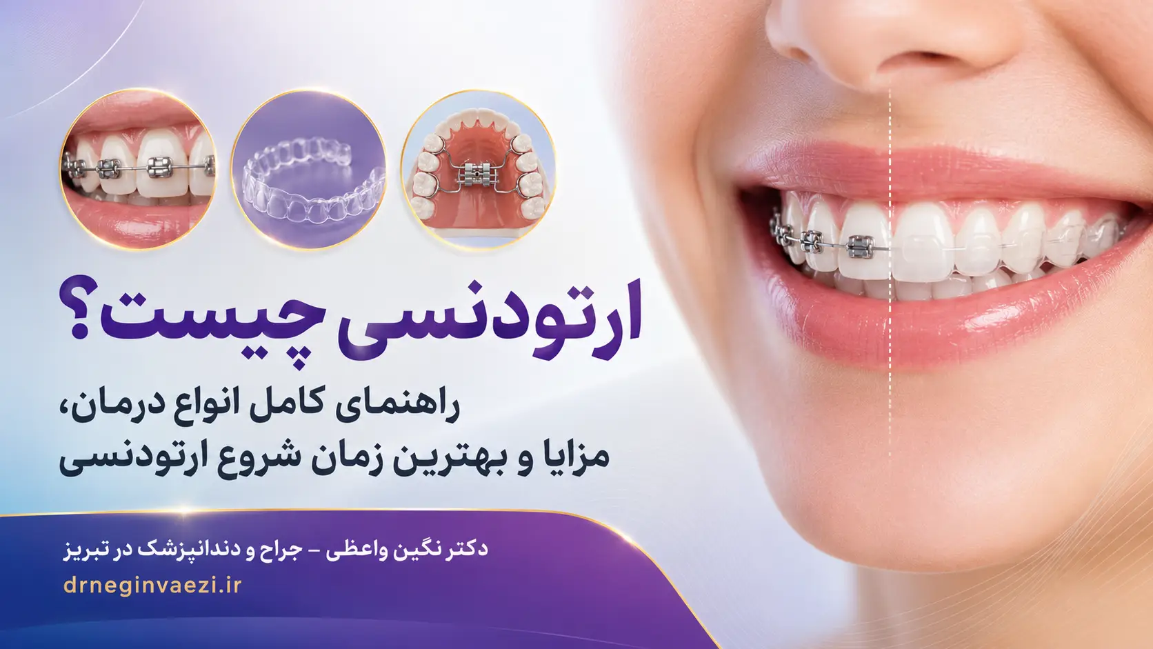 ارتودنسی چیست> ارتودنسی دندان برای اصلاح نامرتبی دندانها و بهبود لبخند