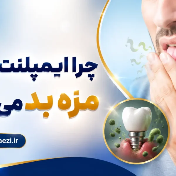Bad taste after dental implant dr negin vaezi 600x600
