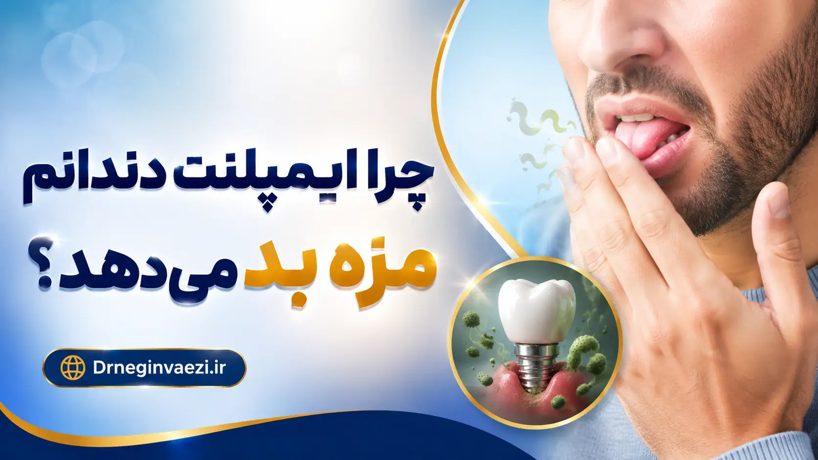 Bad taste after dental implant dr negin vaezi
