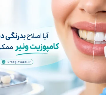 ونیر کامپوزیت برای اصلاح بدرنگی دندان و تغییر رنگ لکه های زرد و خاکستری و قهوه ای