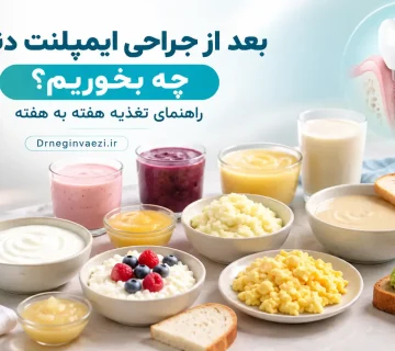 بعد از ایمپلنت دندان چه بخوریم؟ راهنمای تغذیه هفته به هفته