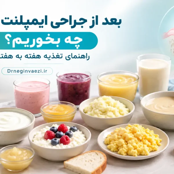 بعد از ایمپلنت دندان چه بخوریم؟ راهنمای تغذیه هفته به هفته